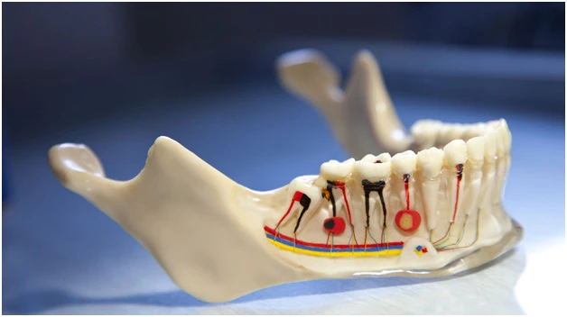 Root canal anatomy and endodontic treatment
