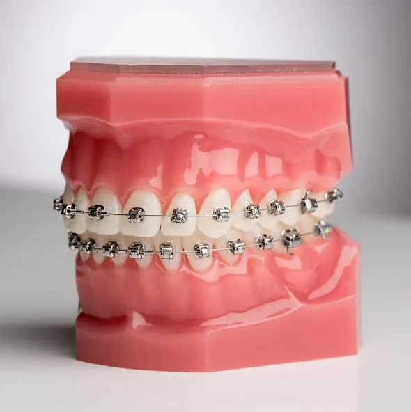 Self-ligating ceramic braces